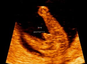 Sonogram Secrets By Trimester Advanced Ultrasound Services