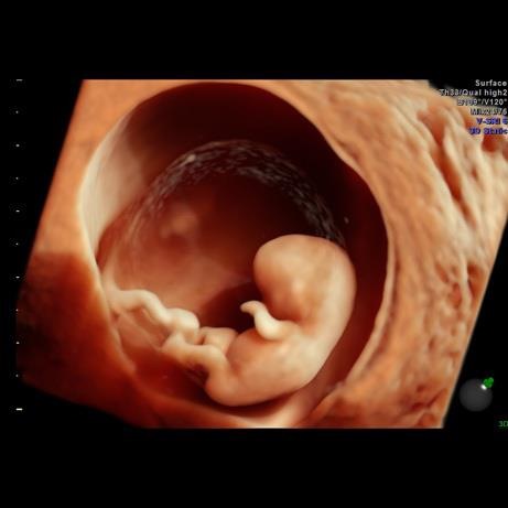 Sonogram Secrets By Trimester Advanced Ultrasound Services